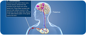 Module 7: Pharmacology of pain medicine